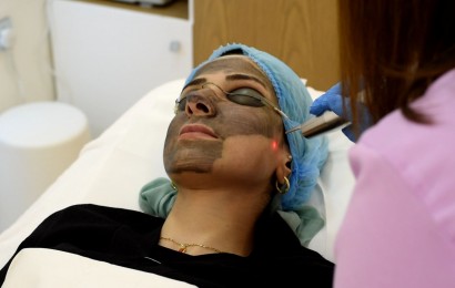 Laser Black Peel - Rejuvenescimento Facial